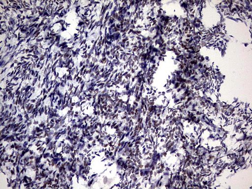 ZNF34 Antibody - IHC of paraffin-embedded Human Ovary tissue using anti-ZNF34 mouse monoclonal antibody. (Heat-induced epitope retrieval by 1 mM EDTA in 10mM Tris, pH8.5, 120°C for 3min).