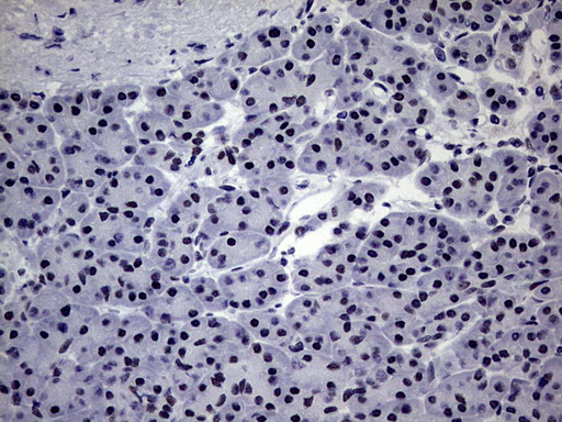 ZNF34 Antibody - IHC of paraffin-embedded Human pancreas tissue using anti-ZNF34 mouse monoclonal antibody. (Heat-induced epitope retrieval by 1 mM EDTA in 10mM Tris, pH8.5, 120°C for 3min).