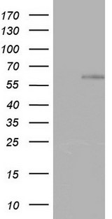 ZNF34 Antibody - HEK293T cells were transfected with the pCMV6-ENTRY control (Left lane) or pCMV6-ENTRY ZNF34 (Right lane) cDNA for 48 hrs and lysed. Equivalent amounts of cell lysates (5 ug per lane) were separated by SDS-PAGE and immunoblotted with anti-ZNF34.