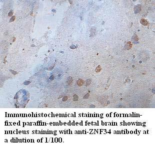 ZNF34 Antibody