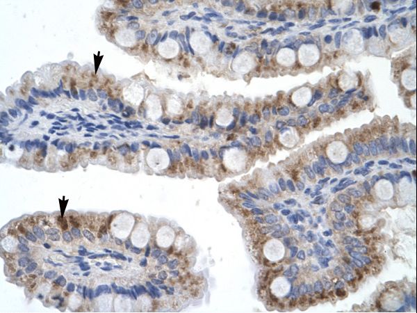 ZNF341 Antibody - ZNF341 antibody ARP30014_P050-NP_116208-ZNF341 (zinc finger protein 341) Antibody was used in IHC to stain formalin-fixed, paraffin-embedded human intestine.  This image was taken for the unconjugated form of this product. Other forms have not been tested.