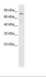 ZNF341 Antibody - HepG2 Cell Lysate.  This image was taken for the unconjugated form of this product. Other forms have not been tested.