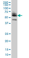 ZNF345 Antibody - ZNF345 monoclonal antibody (M01), clone 6G10 Western blot of ZNF345 expression in HeLa.