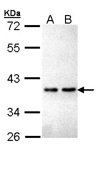 ZNF346 Antibody - Sample (30 ug of whole cell lysate). A: Hela, B: Hep G2 . 12% SDS PAGE. ZNF346 antibody diluted at 1:5000