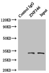 ZNF346 Antibody - Immunoprecipitating ZNF346 in HepG2 whole cell lysate Lane 1: Rabbit control IgG (1µg) instead of ZNF346 Antibody in HepG2 whole cell lysate.For western blotting, a HRP-conjugated anti-rabbit IgG, specific to the non-reduced form of IgG was used as the secondary antibody (1/50000) Lane 2: ZNF346 Antibody (4µg) + HepG2 whole cell lysate (500µg) Lane 3: HepG2 whole cell lysate (20µg)
