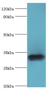 ZNF346 Antibody - Western blot. All lanes: Zinc finger protein 346 antibody at 3 ug/ml+mouse brain tissue. Secondary antibody: Goat polyclonal to rabbit at 1:10000 dilution. Predicted band size: 33 kDa. Observed band size: 33 kDa Immunohistochemistry.