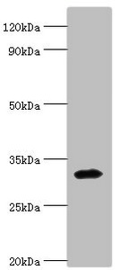 ZNF346 Antibody - Western blot All lanes: Zinc finger protein 346 antibody at 3µg/ml + Mouse brain tissue Secondary Goat polyclonal to rabbit IgG at 1/10000 dilution Predicted band size: 33, 36, 30 kDa Observed band size: 33 kDa
