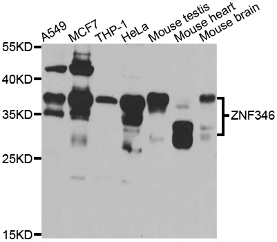 ZNF346 Antibody - Western blot analysis of extracts of various cell lines.