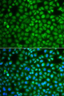 ZNF346 Antibody - Immunofluorescence analysis of A549 cells.