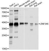 ZNF346 Antibody - Western blot analysis of extracts of various cell lines, using ZNF346 antibody at 1:1000 dilution. The secondary antibody used was an HRP Goat Anti-Rabbit IgG (H+L) at 1:10000 dilution. Lysates were loaded 25ug per lane and 3% nonfat dry milk in TBST was used for blocking. An ECL Kit was used for detection and the exposure time was 1s.