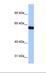ZNF350 Antibody - Fetal brain cell lysate. Antibody concentration: 0.5 ug/ml. Gel concentration: 8%.  This image was taken for the unconjugated form of this product. Other forms have not been tested.