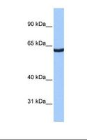 ZNF350 Antibody - HepG2 cell lysate. Antibody concentration: 0.5 ug/ml. Gel concentration: 8%.  This image was taken for the unconjugated form of this product. Other forms have not been tested.