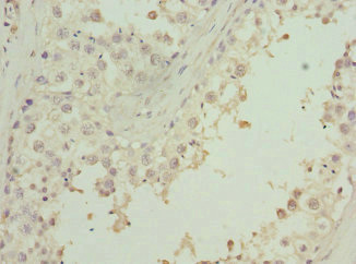 ZNF350 Antibody - Immunohistochemistry of paraffin-embedded human testis tissue at dilution 1:100