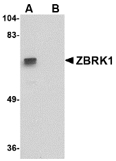 ZNF350 Antibody - Western blot of ZBRK1 in A-20 lysate with ZBRK1 antibody at 1 ug/ml in (A) the absence and (B) the presence of blocking peptide.