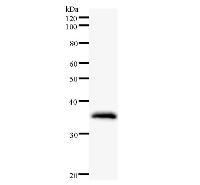 ZNF354A Antibody - Western blot analysis of immunized recombinant protein, using anti-ZNF354A monoclonal antibody.
