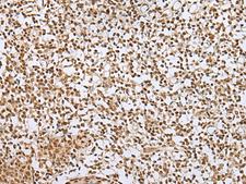 ZNF354A Antibody - Immunohistochemistry of paraffin-embedded Human tonsil tissue  using ZNF354A Polyclonal Antibody at dilution of 1:40(×200)