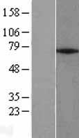 ZNF354A Protein - Western validation with an anti-DDK antibody * L: Control HEK293 lysate R: Over-expression lysate