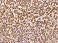 ZNF354C Antibody - Immunochemical staining of human ZNF354C in human liver with rabbit polyclonal antibody at 1:500 dilution, formalin-fixed paraffin embedded sections.