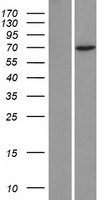 ZNF354C Protein - Western validation with an anti-DDK antibody * L: Control HEK293 lysate R: Over-expression lysate