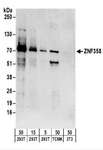 ZNF358 / ZFEND1 Antibody - Detection of Human and Mouse ZNF358 by Western Blot. Samples: Whole cell lysate from 293T (5, 15 and 50 ug), mouse TCMK-1 (50 ug), and mouse NIH3T3 (50 ug) cells. Antibodies: Affinity purified rabbit anti-ZNF358 antibody used for WB at 0.1 ug/ml. Detection: Chemiluminescence with an exposure time of 3 minutes.