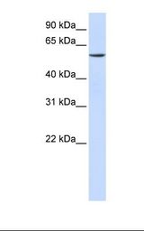 ZNF358 / ZFEND1 Antibody - Fetal lung lysate. Antibody concentration: 1.0 ug/ml. Gel concentration: 12%.  This image was taken for the unconjugated form of this product. Other forms have not been tested.
