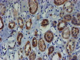 ZNF365 Antibody - IHC of paraffin-embedded Human Kidney tissue using anti-ZNF365 mouse monoclonal antibody. (Heat-induced epitope retrieval by 10mM citric buffer, pH6.0, 100C for 10min).