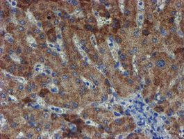 ZNF365 Antibody - IHC of paraffin-embedded Human liver tissue using anti-ZNF365 mouse monoclonal antibody. (Heat-induced epitope retrieval by 10mM citric buffer, pH6.0, 100C for 10min).
