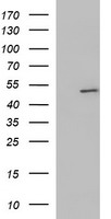 ZNF365 Antibody - HEK293T cells were transfected with the pCMV6-ENTRY control (Left lane) or pCMV6-ENTRY ZNF365 (Right lane) cDNA for 48 hrs and lysed. Equivalent amounts of cell lysates (5 ug per lane) were separated by SDS-PAGE and immunoblotted with anti-ZNF365.