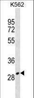 ZNF365 Antibody - ZNF365 Antibody western blot of K562 cell line lysates (35 ug/lane). The ZNF365 antibody detected the ZNF365 protein (arrow).