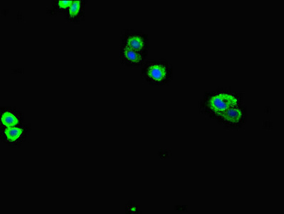 ZNF365 Antibody - Immunofluorescent analysis of HepG2 cells diluted at 1:100 and Alexa Fluor 488-congugated AffiniPure Goat Anti-Rabbit IgG(H+L)