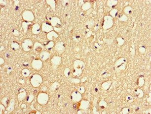 ZNF365 Antibody - Immunohistochemistry of paraffin-embedded human brain tissue at dilution of 1:100