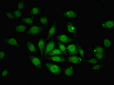 ZNF366 Antibody - Immunofluorescent analysis of A549 cells using ZNF366 Antibody at dilution of 1:100 and Alexa Fluor 488-congugated AffiniPure Goat Anti-Rabbit IgG(H+L)