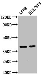 ZNF367 Antibody - Western Blot Positive WB detected in: K562 whole cell lysate, NIH/3T3 whole cell lysate All Lanes: ZNF367 antibody at 6µg/ml Secondary Goat polyclonal to rabbit IgG at 1/50000 dilution Predicted band size: 39, 33 KDa Observed band size: 39 KDa