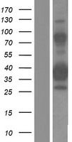 ZNF367 Protein - Western validation with an anti-DDK antibody * L: Control HEK293 lysate R: Over-expression lysate