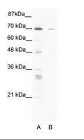 ZNF37A Antibody - A: Marker, B: HepG2 Cell Lysate.  This image was taken for the unconjugated form of this product. Other forms have not been tested.
