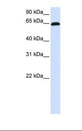 ZNF37A Antibody - Placenta lysate. Antibody concentration: 1.0 ug/ml. Gel concentration: 12%.  This image was taken for the unconjugated form of this product. Other forms have not been tested.