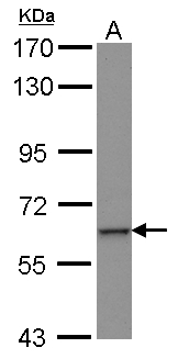 ZNF37A Antibody - Sample (30 ug of whole cell lysate) A: HepG2 7.5% SDS PAGE ZNF37A antibody diluted at 1:1000