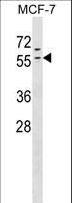 ZNF383 Antibody - ZNF383 Antibody western blot of MCF-7 cell line lysates (35 ug/lane). The ZNF383 antibody detected the ZNF383 protein (arrow).