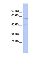 ZNF384 Antibody - ZNF384 antibody Western blot of Fetal Small Intestine lysate. This image was taken for the unconjugated form of this product. Other forms have not been tested.