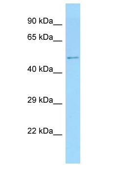 ZNF384 Antibody - ZNF384 antibody Western Blot of Rat Small Intestine. Antibody dilution: 1 ug/ml.  This image was taken for the unconjugated form of this product. Other forms have not been tested.