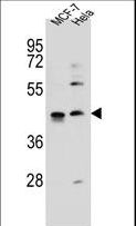 ZNF384 Antibody - ZNF384 Antibody western blot of MCF-7,HeLa cell line lysates (35 ug/lane). The ZNF384 antibody detected the ZNF384 protein (arrow).