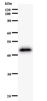 ZNF384 Antibody - Western blot of immunized recombinant protein using ZNF384 antibody.