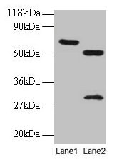 ZNF384 Antibody - Western blot All lanes: Zinc finger protein 384 antibody at 2µg/ml Lane 1: EC109 whole cell lysate Lane 2: 293T whole cell lysate Secondary Goat polyclonal to rabbit IgG at 1/15000 dilution Predicted band size: 64, 57, 51 kDa Observed band size: 64, 51, 30 kDa