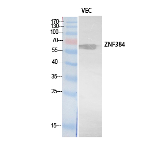 ZNF384 Antibody - Western Blot analysis of extracts from VEC cells using ZNF384 Antibody.