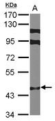 ZNF384 Antibody - Sample (30 ug of whole cell lysate) A: MCF-7 7.5% SDS PAGE ZNF384 antibody diluted at 1:1000
