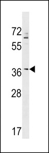 ZNF385A / ZNF385 Antibody - ZNF385A Antibody western blot of K562 cell line lysates (35 ug/lane). The ZNF385A antibody detected the ZNF385A protein (arrow).