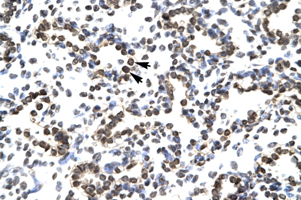 ZNF385A / ZNF385 Antibody - ZNF385A / ZNF385 antibody ARP32542_P050-NP_056296-ZNF385 (zinc finger protein 385) Antibody IHC staining of formalin-fixed, paraffin-embedded human Lung. Positive label: Alveolar cells indicated with arrows. Antibody concentration 4-8 ug/ml. Magnification 400X.  This image was taken for the unconjugated form of this product. Other forms have not been tested.