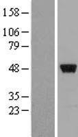 ZNF385A / ZNF385 Protein - Western validation with an anti-DDK antibody * L: Control HEK293 lysate R: Over-expression lysate