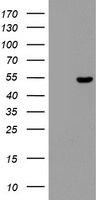 ZNF385B / ZNF533 Antibody - HEK293T cells were transfected with the pCMV6-ENTRY control (Left lane) or pCMV6-ENTRY ZNF385B (Right lane) cDNA for 48 hrs and lysed. Equivalent amounts of cell lysates (5 ug per lane) were separated by SDS-PAGE and immunoblotted with anti-ZNF385B.
