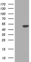 ZNF385B / ZNF533 Antibody - HEK293T cells were transfected with the pCMV6-ENTRY control (Left lane) or pCMV6-ENTRY ZNF385B (Right lane) cDNA for 48 hrs and lysed. Equivalent amounts of cell lysates (5 ug per lane) were separated by SDS-PAGE and immunoblotted with anti-ZNF385B.